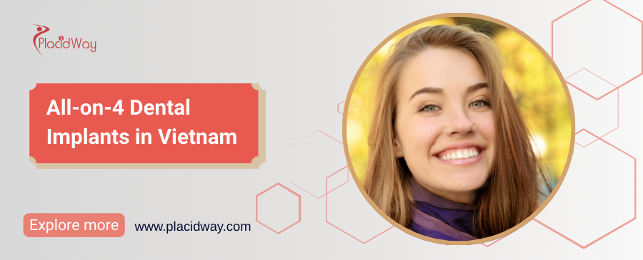 Дентальные имплантаты All-on-4 во Вьетнаме