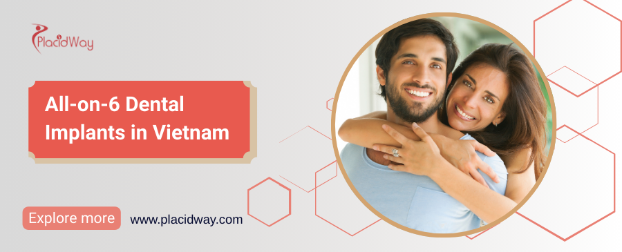 Дентальные имплантаты All-on-6 во Вьетнаме