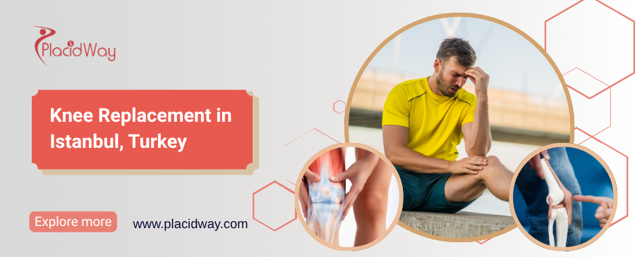 Замена коленного сустава в Стамбуле, Турция
