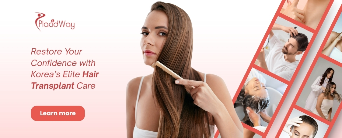 Пересадка волос в Южной Корее