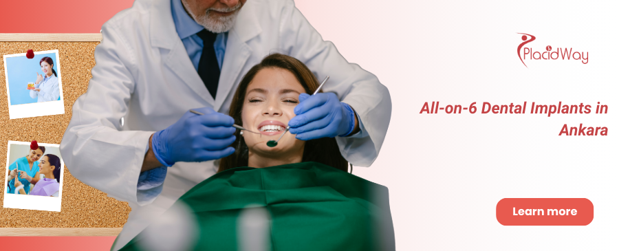 Имплантация All-on-6, Анкара, Турция